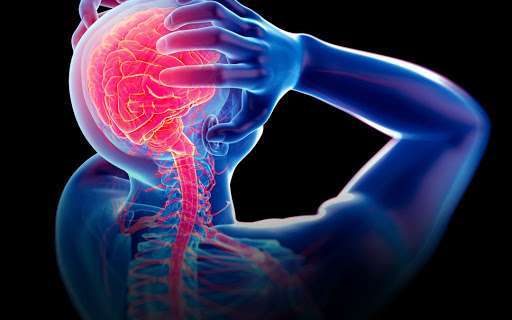 Migraines